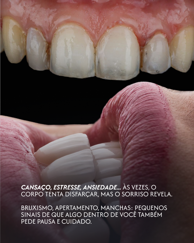 Peça de conscientização sobre bruxismo e saúde bucal