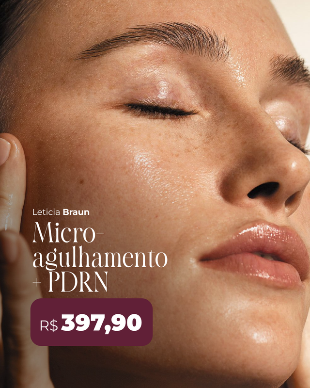 Peça para Instagram sobre microagulhamento com PDRN